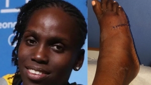 Jamaican bobsledder Carrie Russell on the mend after suffering horrific foot injury while training