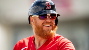 Red Sox All-Star Justin Turner requires 16 stitches after taking fastball to the face