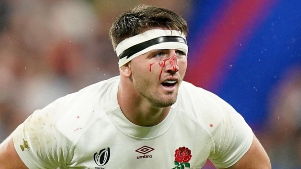 England flanker Tom Curry refuses to set comeback date after major hip surgery